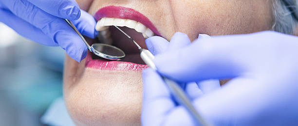 Best Emergency Tooth Extraction in Tahlequah, OK